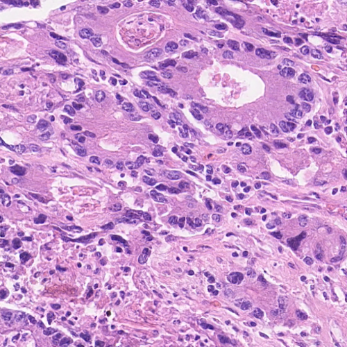 Figure 21