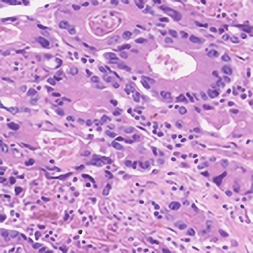 Figure 23