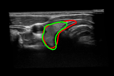 Figure 11
