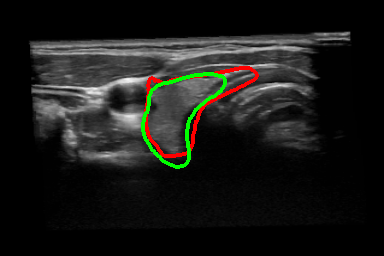 Figure 12