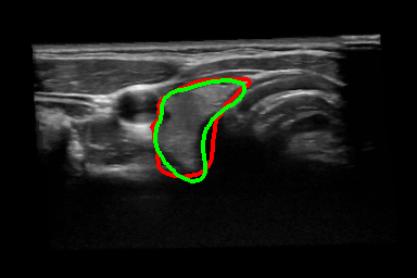 Figure 13