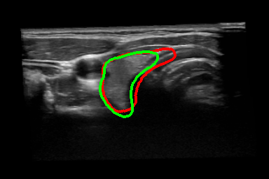 Figure 14