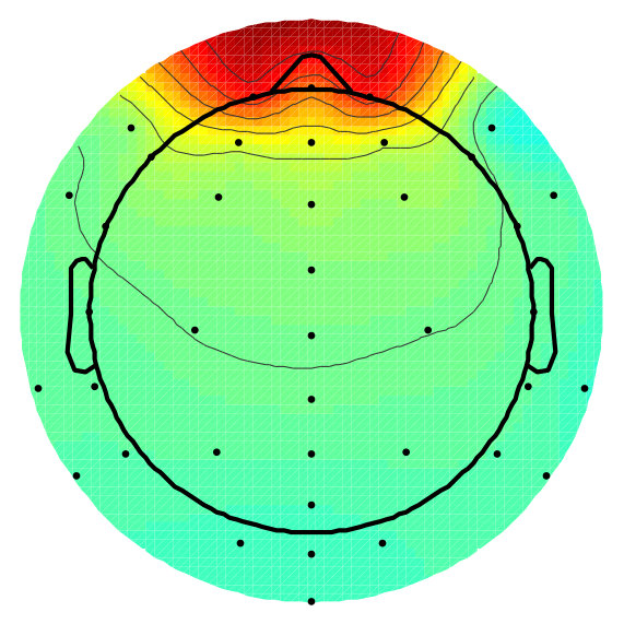 Figure 13