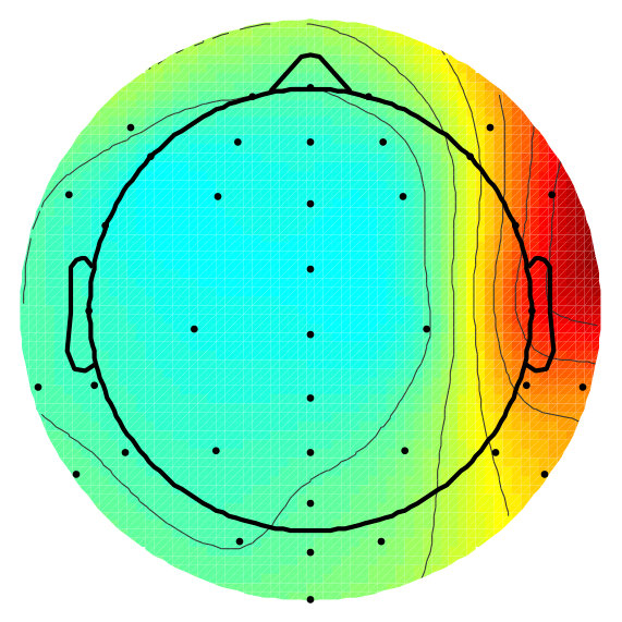 Figure 14