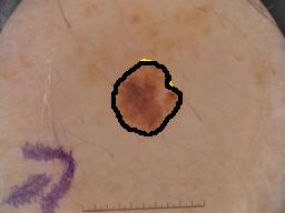 Figure 12