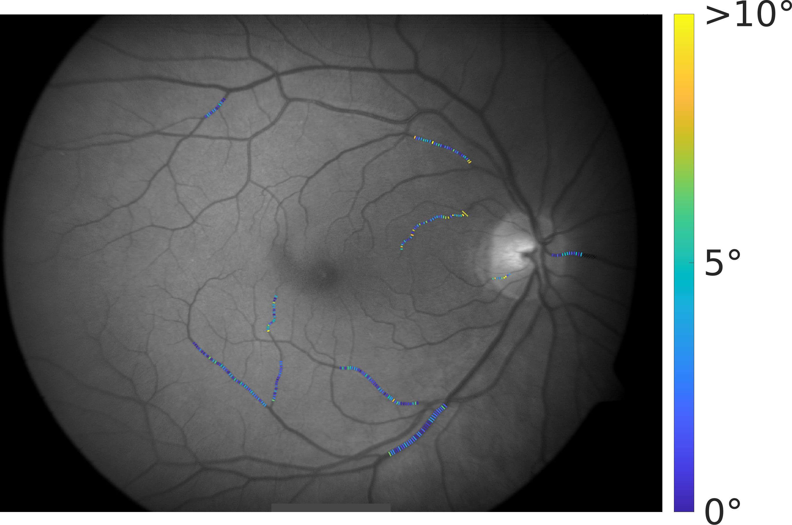 Figure 21