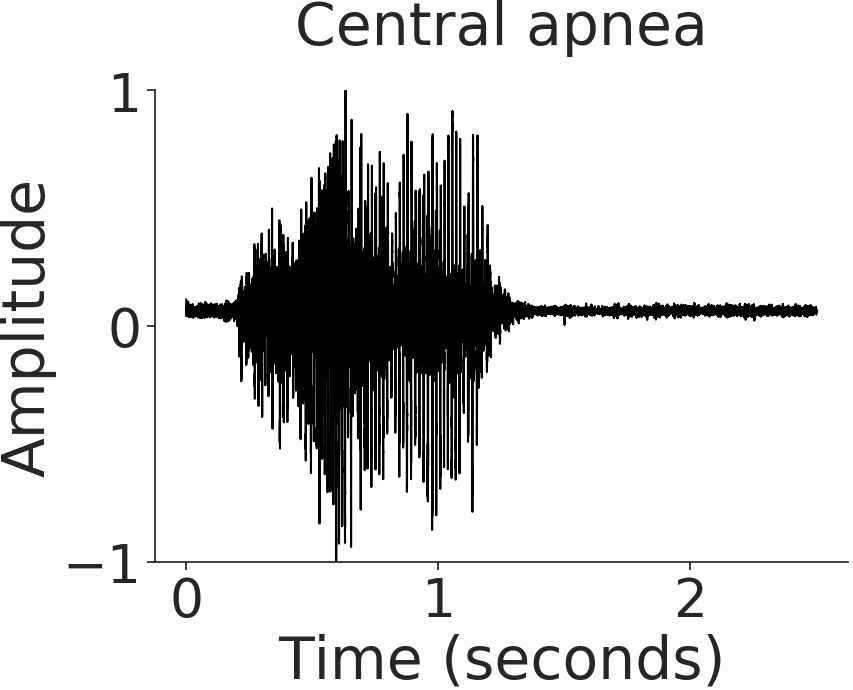 Figure 30