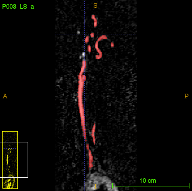 Figure 14