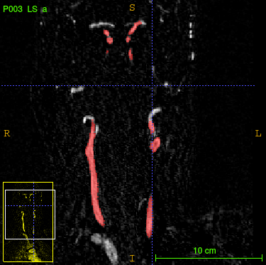 Figure 15