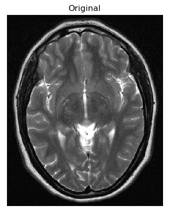 Figure 33