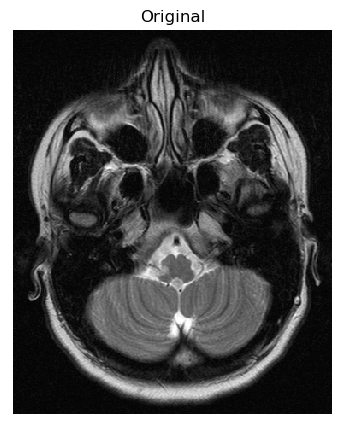 Figure 36