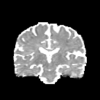 Figure 22