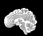 Figure 24