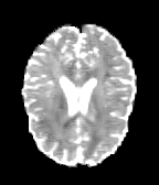 Figure 29