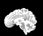 Figure 30