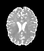 Figure 32