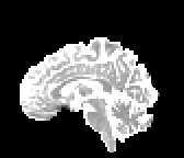 Figure 33