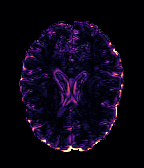Figure 38