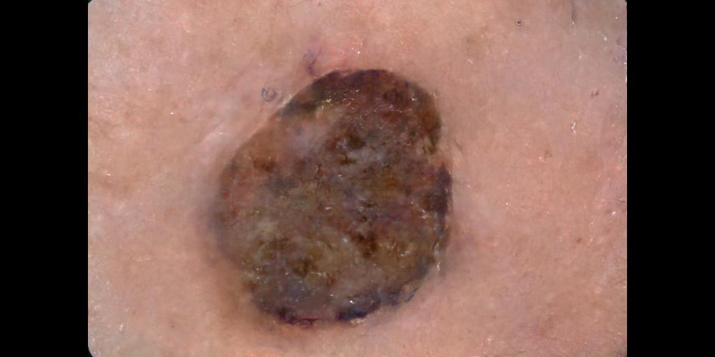 Figure 13