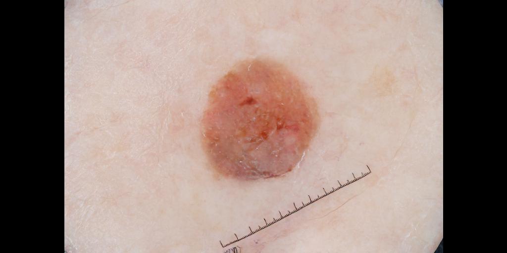 Figure 16