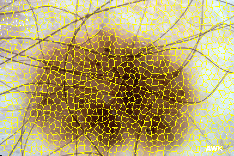 Figure 18