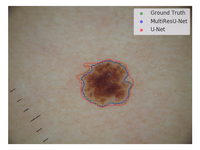 Figure 11