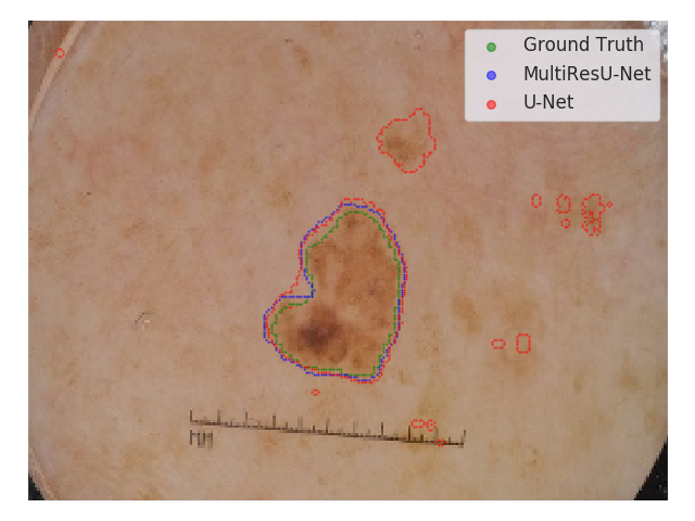 Figure 21