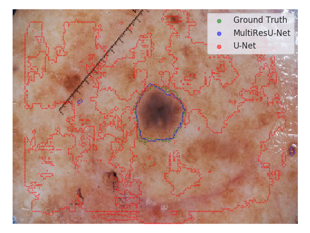 Figure 22