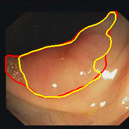 Figure 30