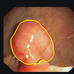 Figure 31
