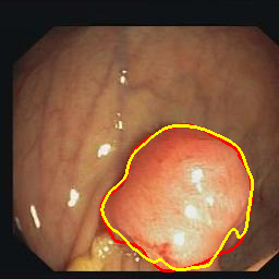 Figure 32