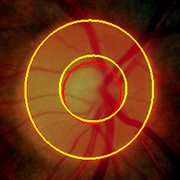 Figure 33