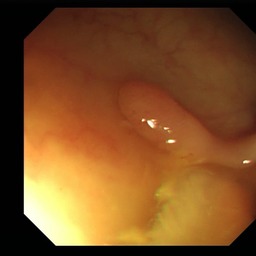 Figure 37