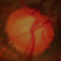 Figure 38