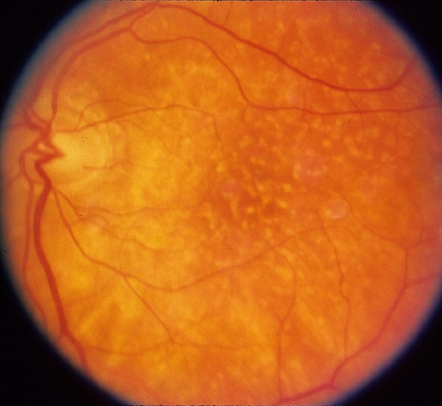 Figure 13