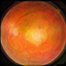 Figure 13