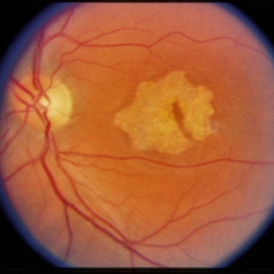 Figure 4