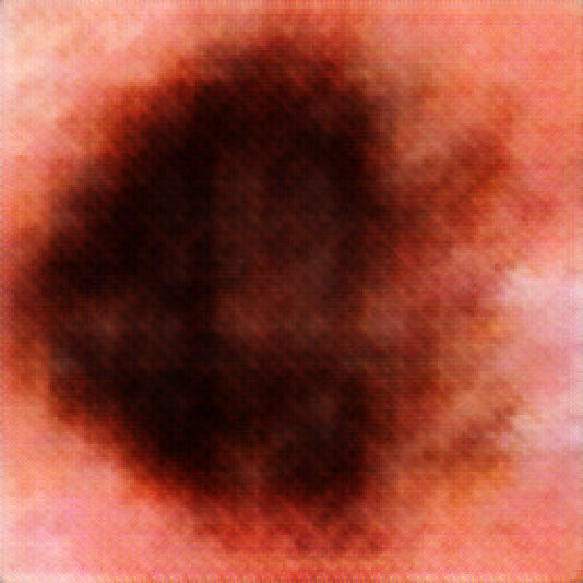Figure 12