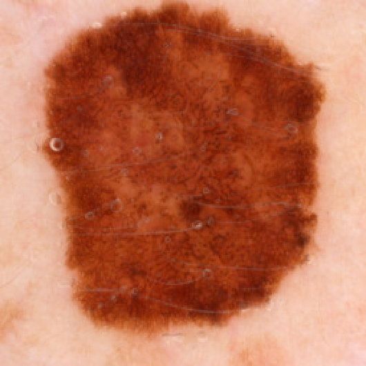 Figure 13