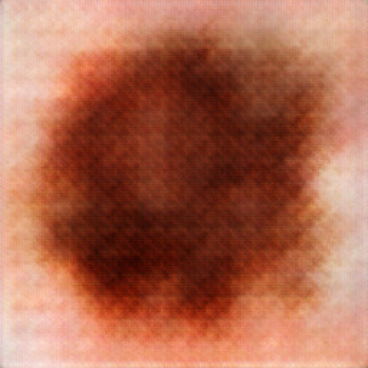 Figure 14