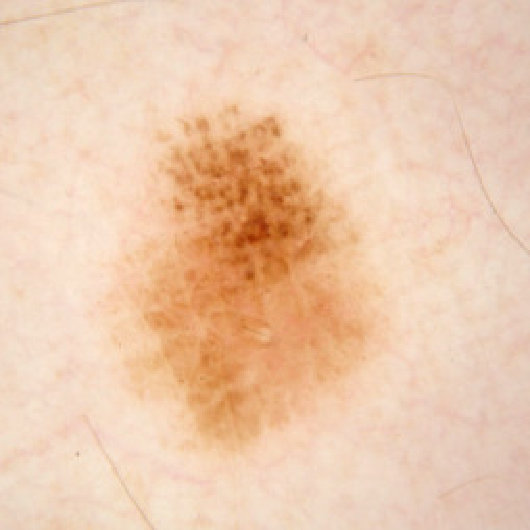 Figure 17