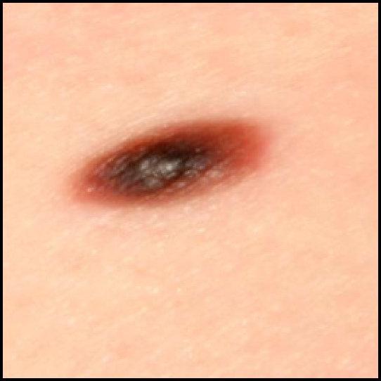 Figure 19