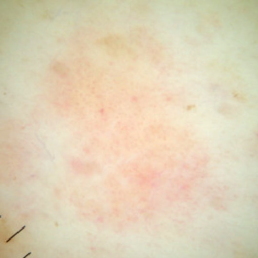 Figure 23