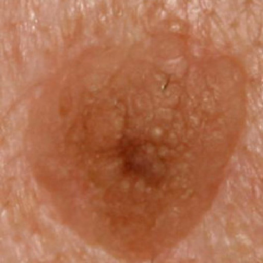 Figure 26