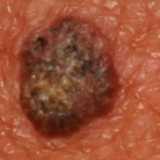 Figure 28