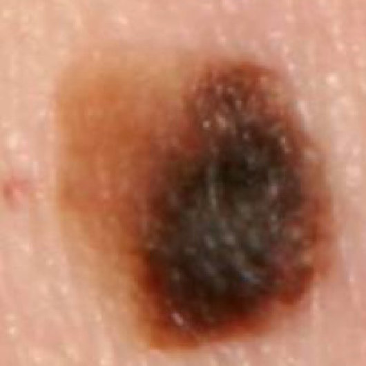 Figure 30