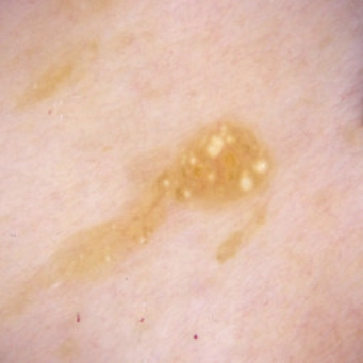 Figure 32