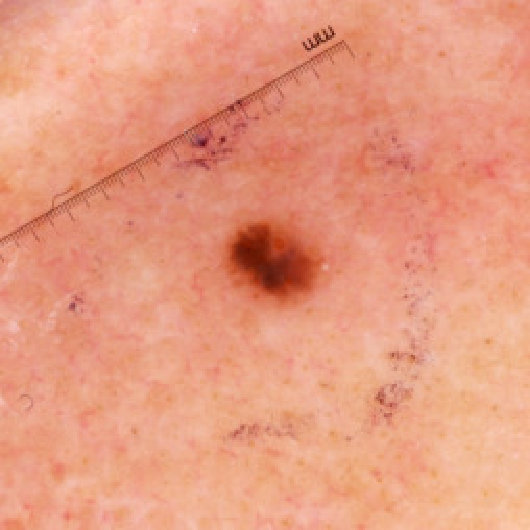 Figure 36