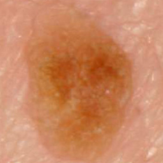 Figure 40