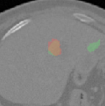 Figure 16